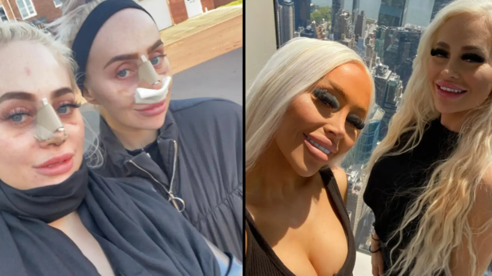 Twins who are obsessed with Barbie have spent more than £160,000 to look like the iconic doll