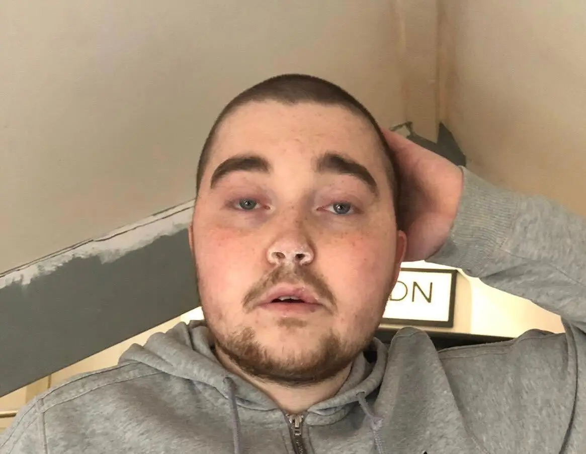 Jack was addicted to ketamine for several years (Jack Curran)