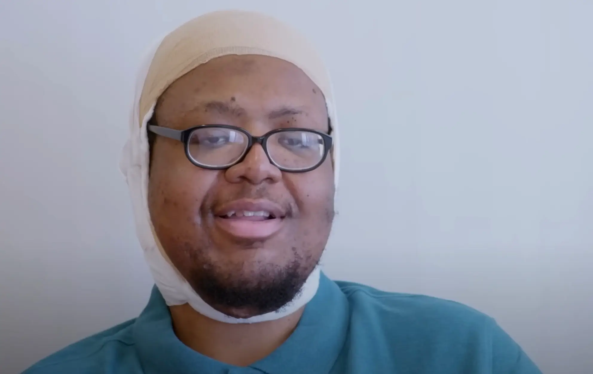 The 33-year-old had visited numerous doctors but couldn't find one willing to remove the growth (TLC)