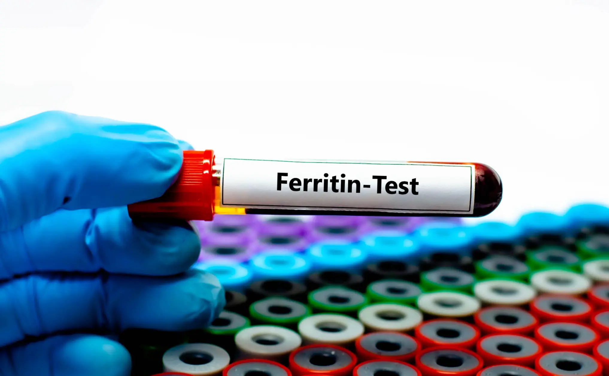 Ferritin is a hormone which is linked to iron levels in the body (Press Association)
