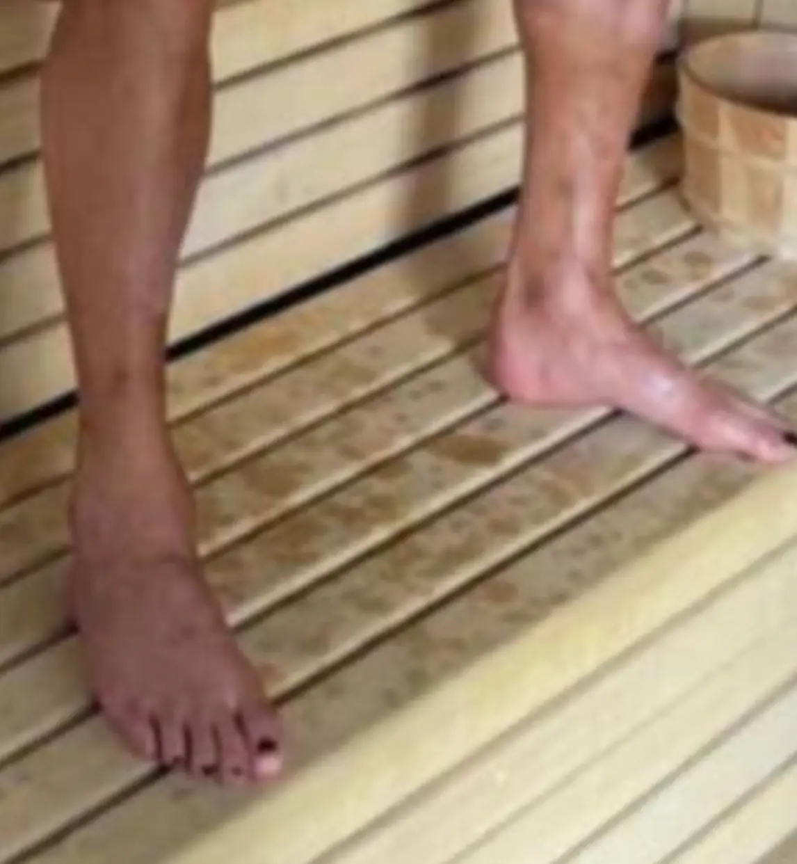 "Many top athletes do this to protect their nails from fungi and bacteria."