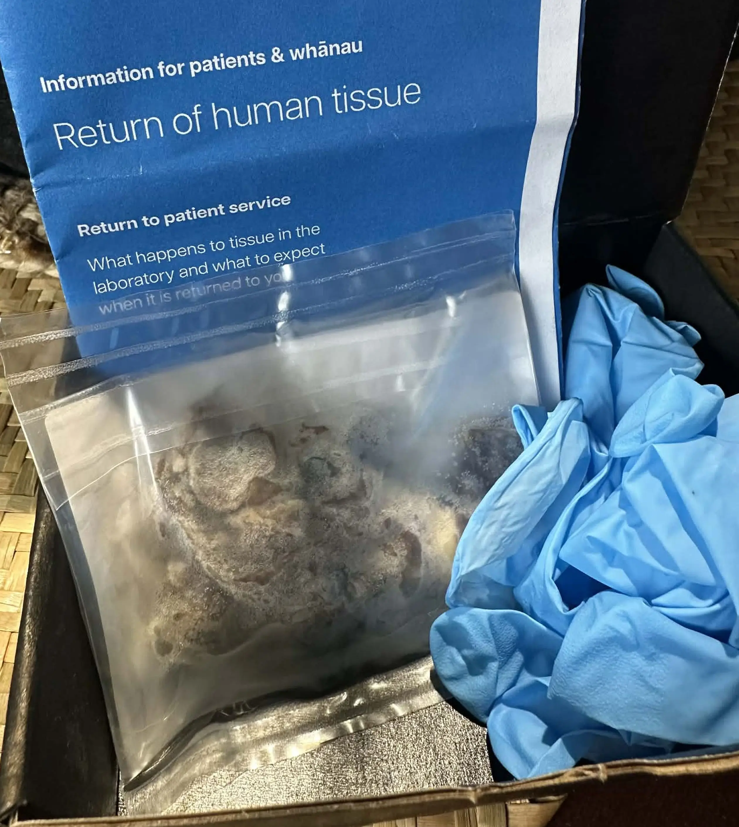 The family plan on burying it (Kennedy News and Media)