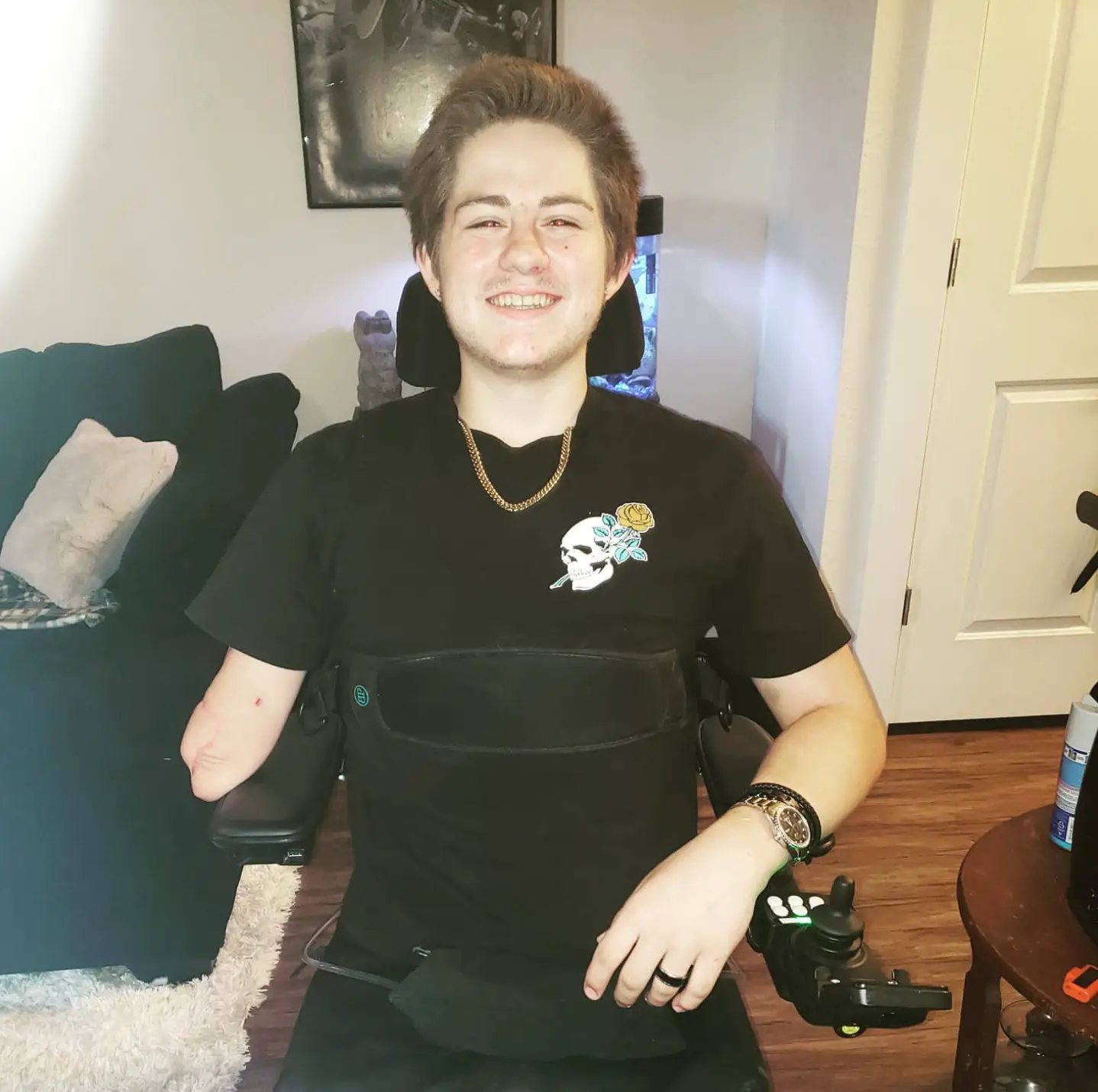 Loren Schauers was forced to have his lower body and one arm amputated following a life-changing accident in 2019 (Instagram/@loren.schauers)