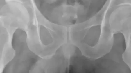 37-Year-Old Virgin Gets 6-foot String Stuck In Penis During Sex Game