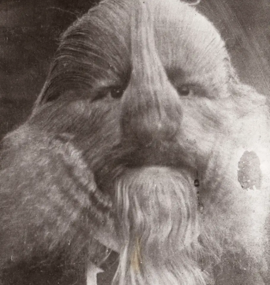 The hair on Bibrowski's head grew to 20cm in length.