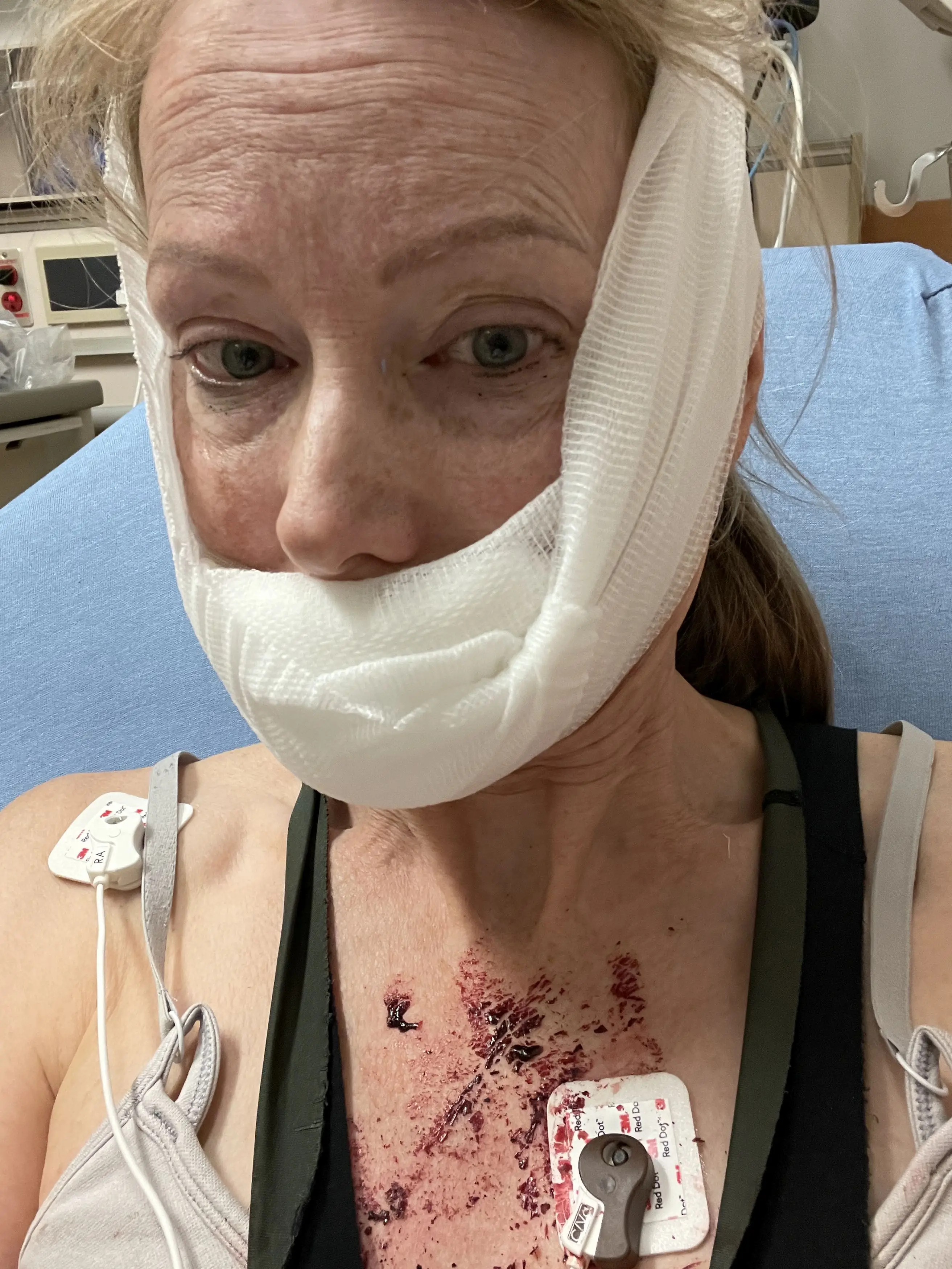 She underwent emergency surgery following the dog bite (Kennedy News and Media)