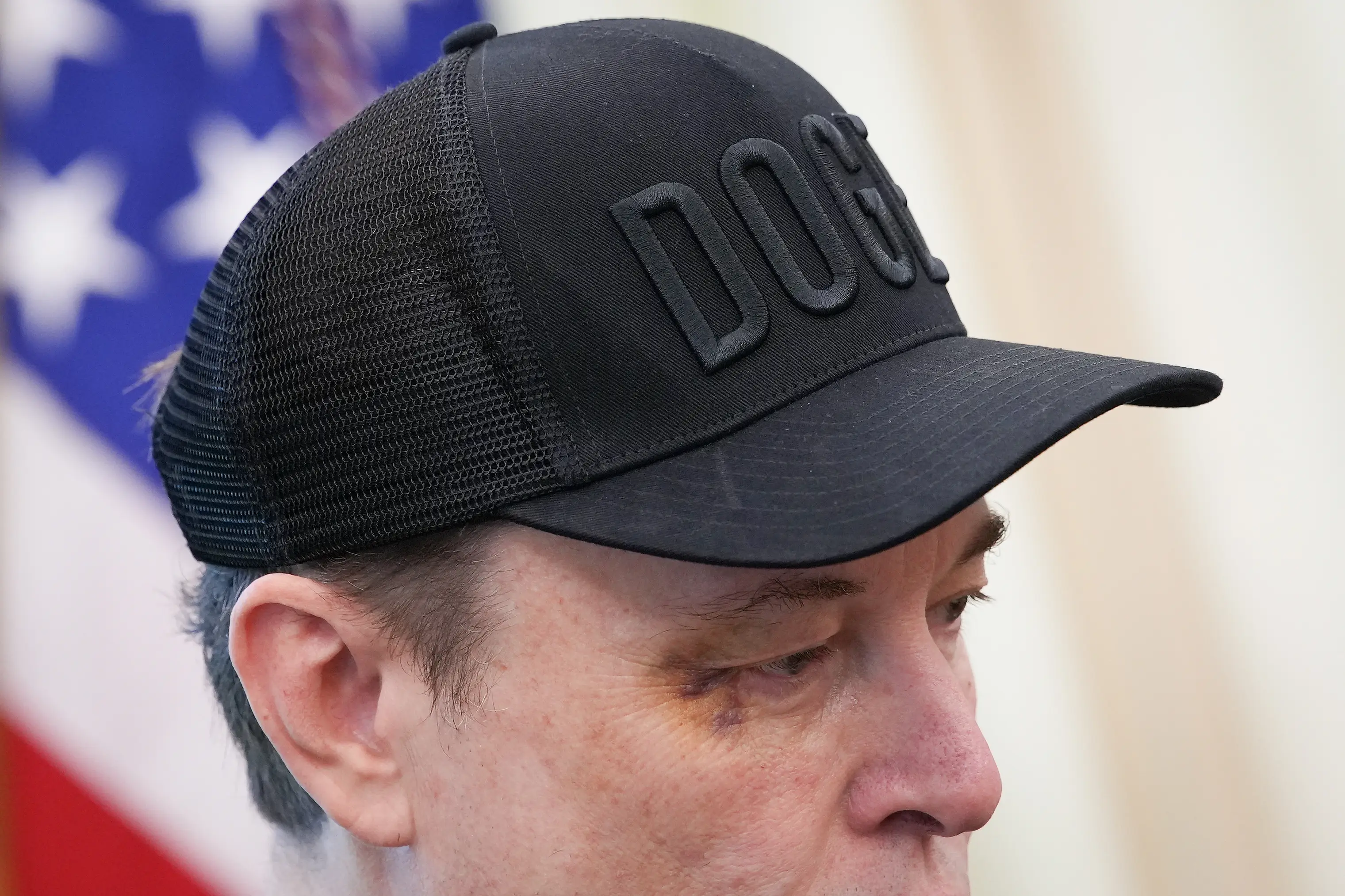 Musk said he got the bruise on his eye from 'horsing around' with his son and challenging the child to punch him in the face (Kevin Dietsch/Getty Images)