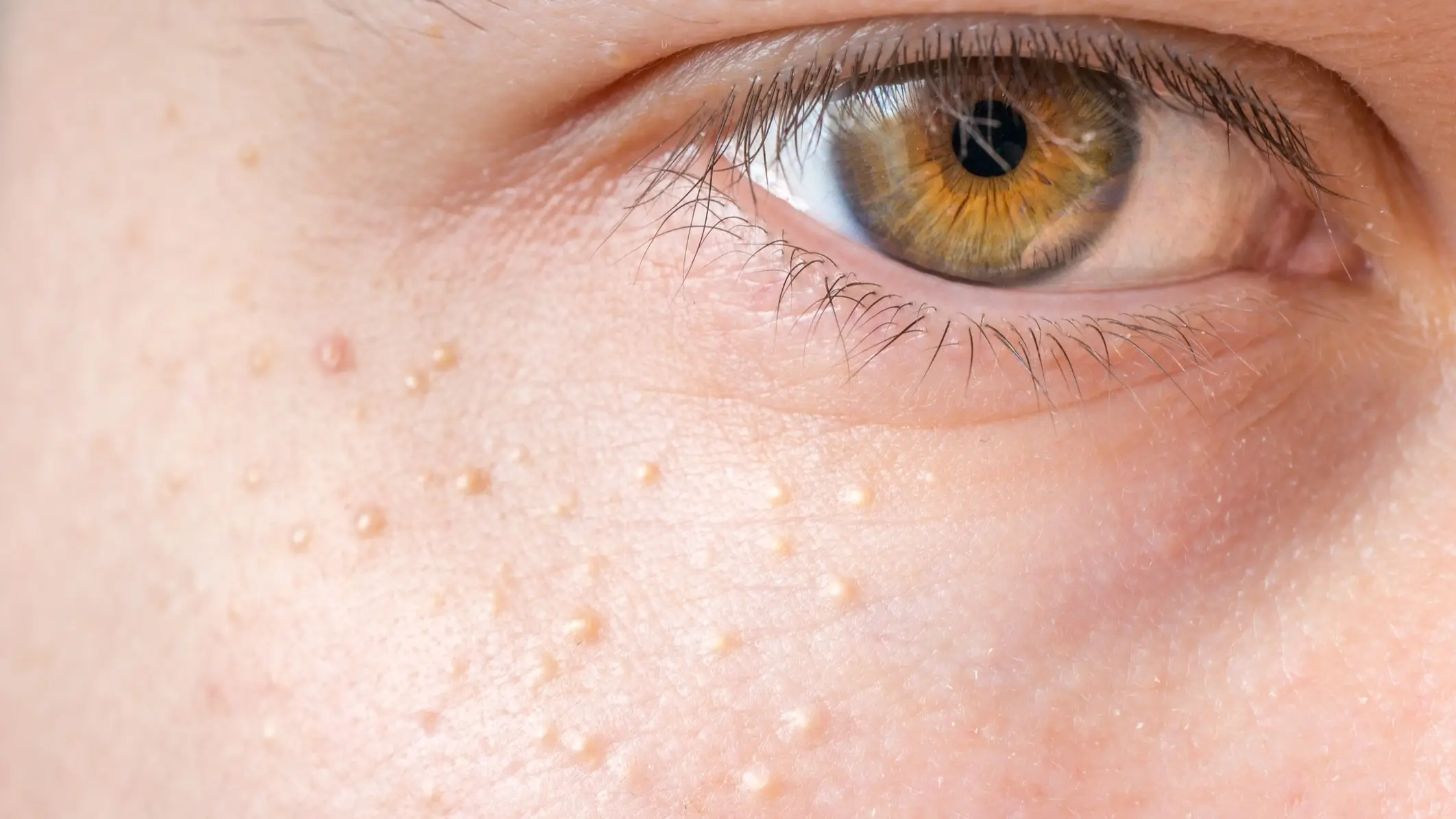 (Getty Stock Images)