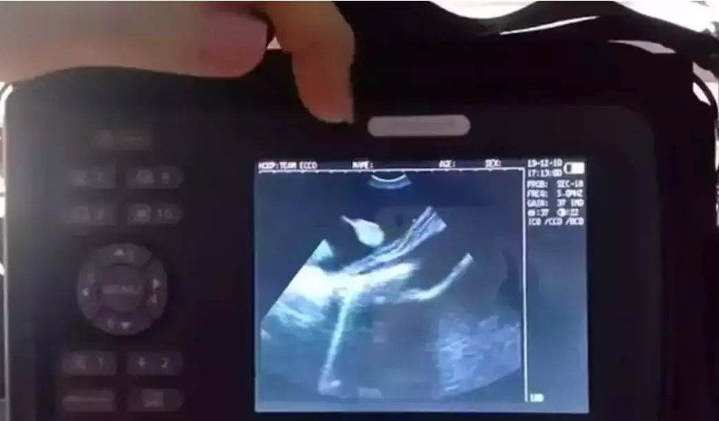 Team ECCO shared scan pictures of the pups in the stingrays stomach (Team ECCO)