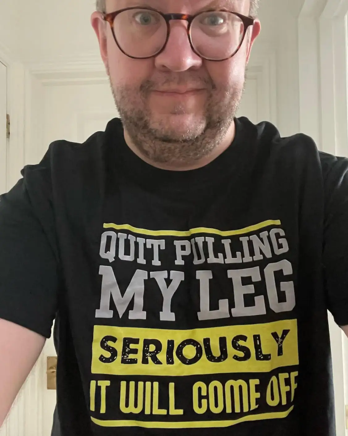 Hopper purposely caused the damage which led to his legs being amputated (Instagram)