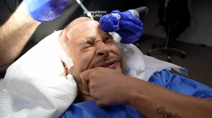 Cole said the pain was roughly an eight out of 10 (YouTube/Cole Anderson-James)