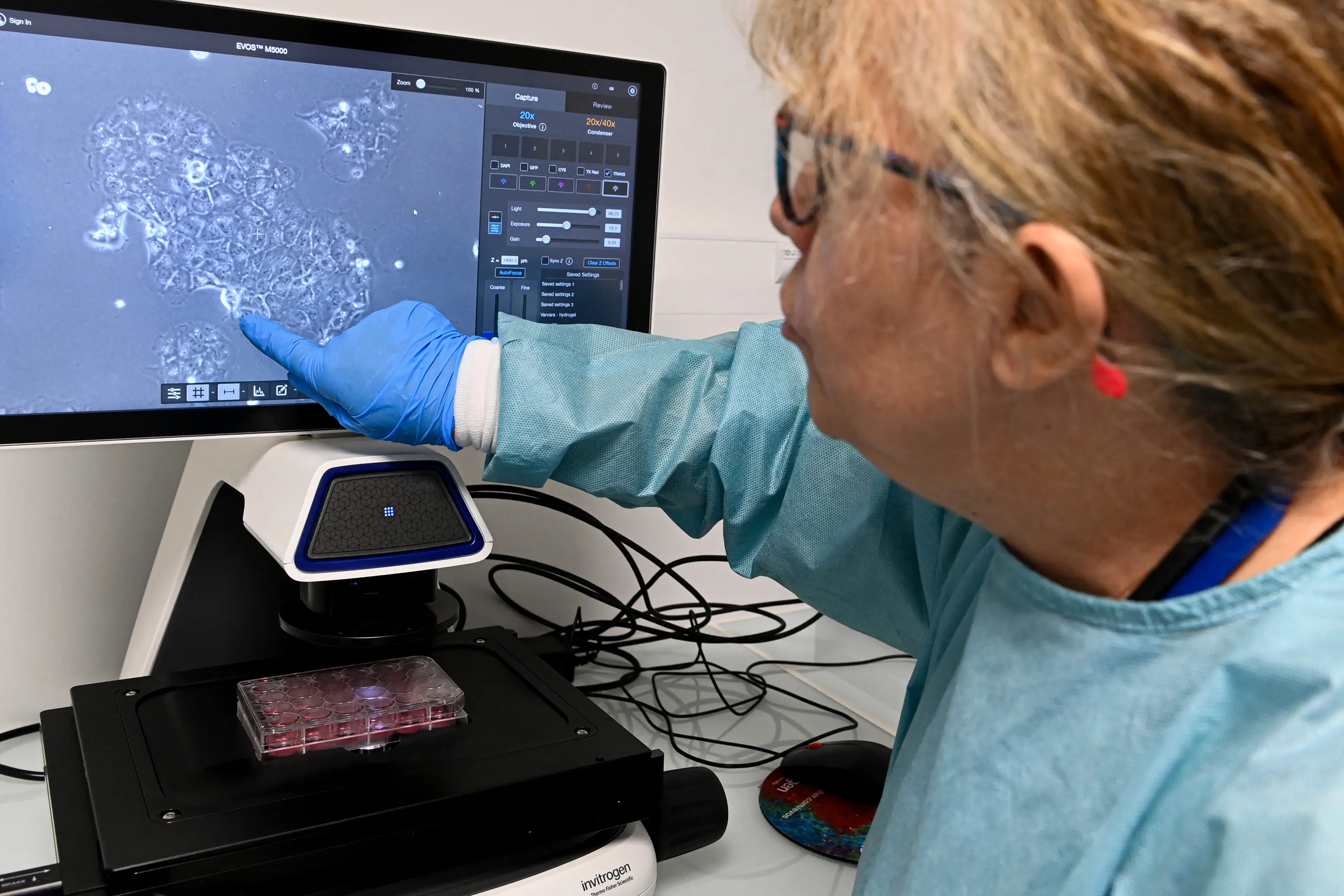 Pancreatic cancer cells on a hospital monitor (Getty Stock)