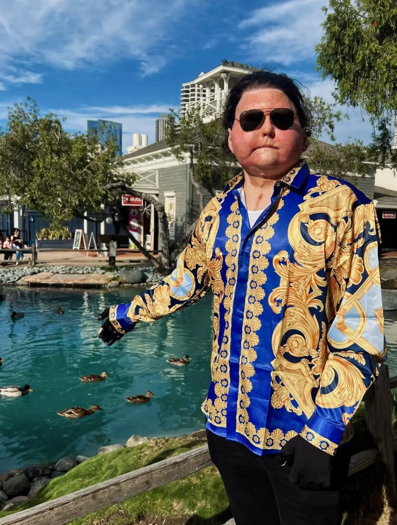 Joe DiMeo, 26, has revealed what he remembers from his three-month coma (Instagram/@joeroydimeo)