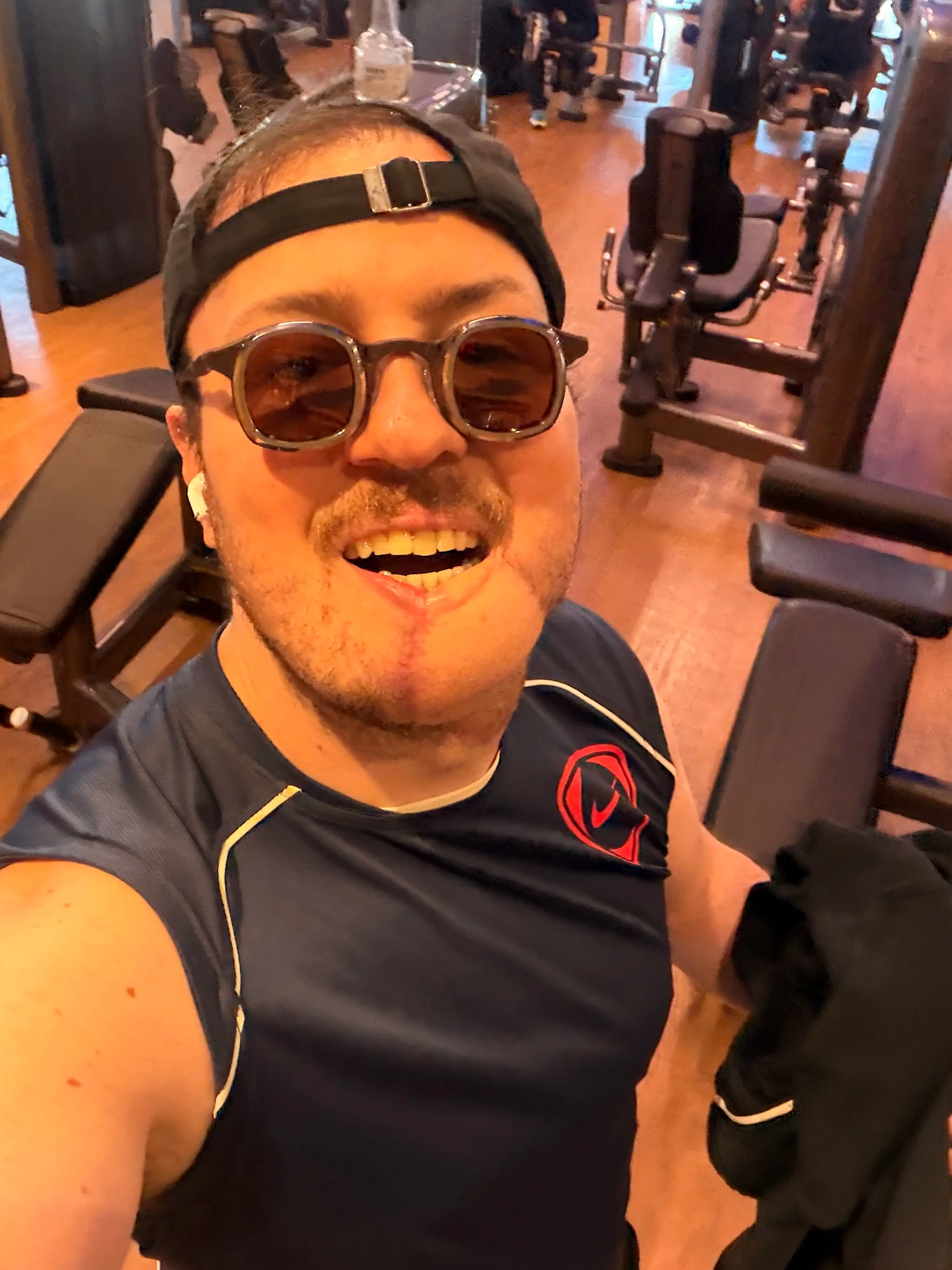 Things have healed up nicely after André's accident (SWNS)