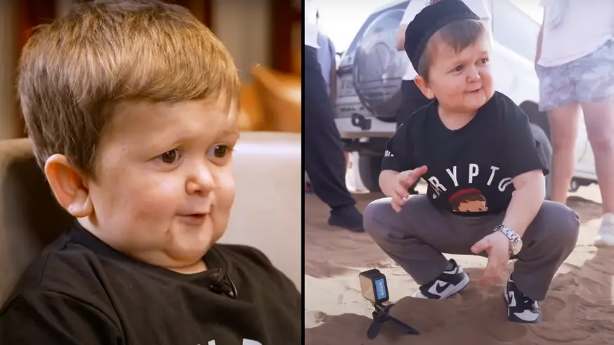 Hasbulla Finally Sat Down For His First Ever Interview And It Was Wild