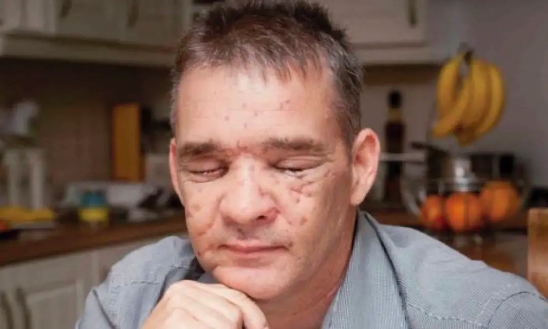 PC David Rathband was shot in the face by Raoul Moat (Northumbria Police Federation)