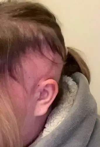 The mum, who had to have a craniotomy, added that it can be hard to get access to scans which could detect a tumour. (SWNS)