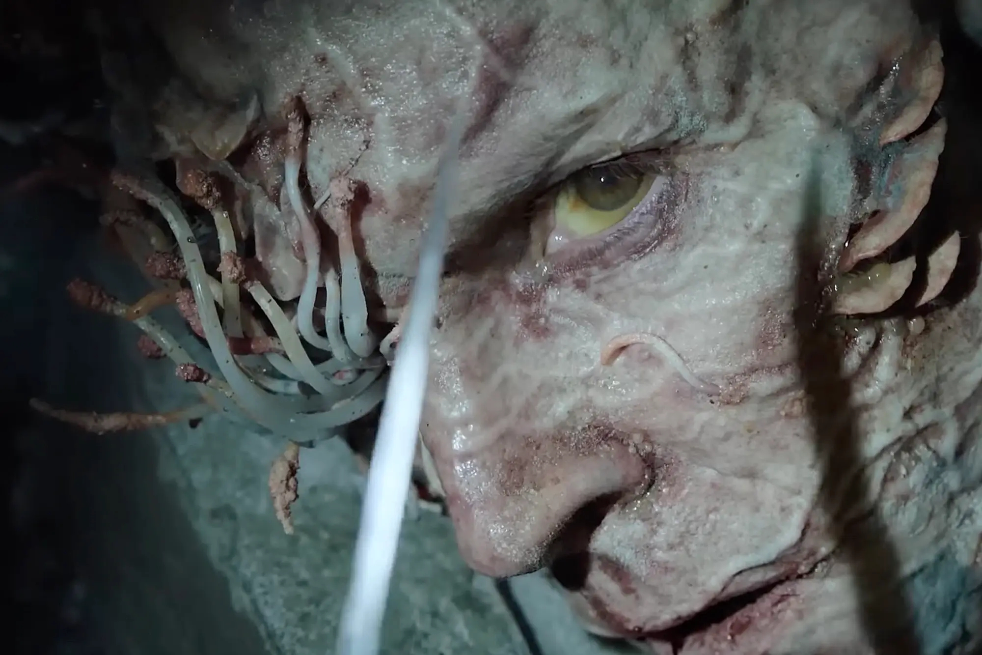 Stalkers are in the second stage of infection.