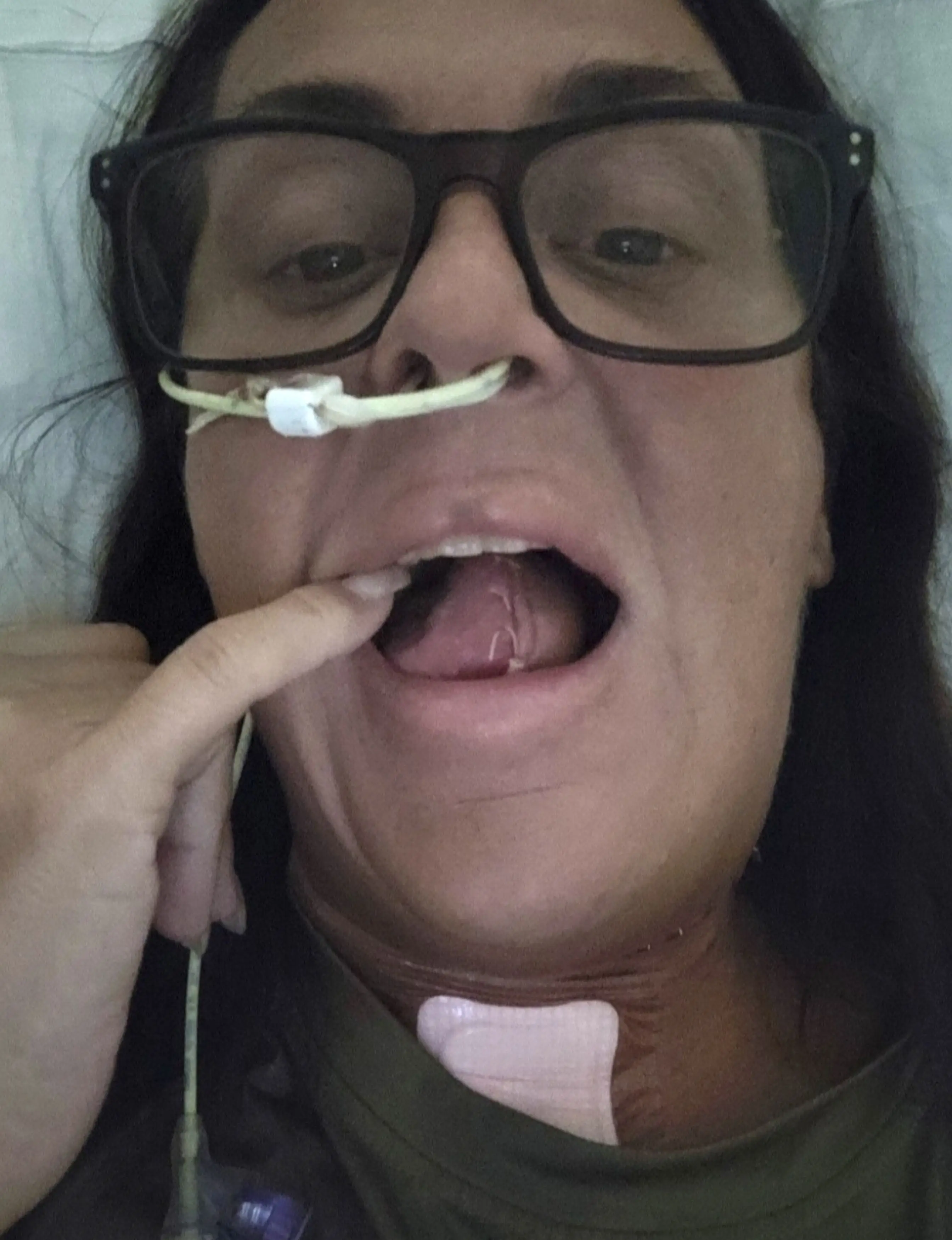 Sharon underwent surgery shortly after the problem was discovered (Kennedy News and Media)