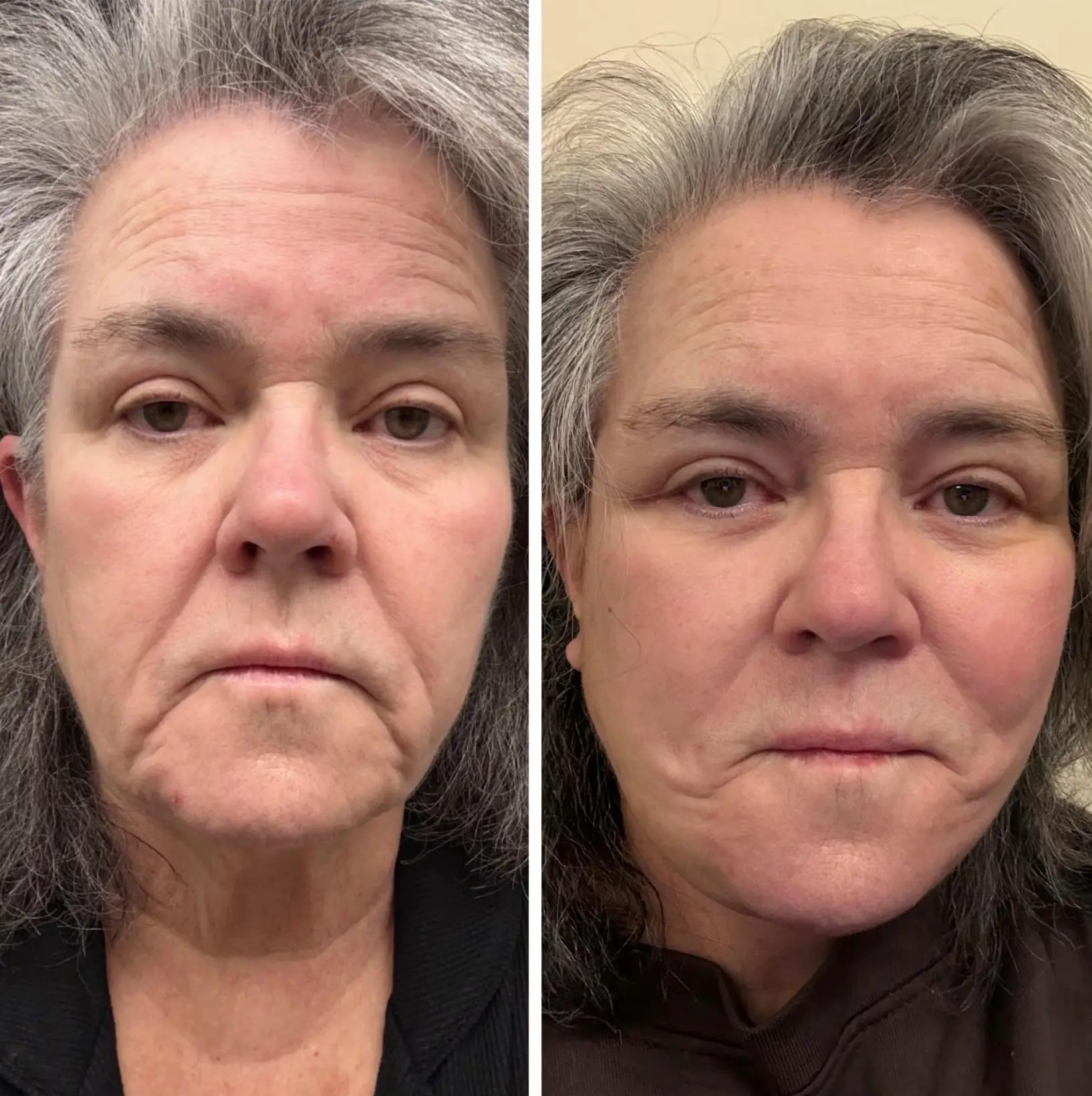 O'Donnell shared a before and after picture with fans (Instagram/@rosie)