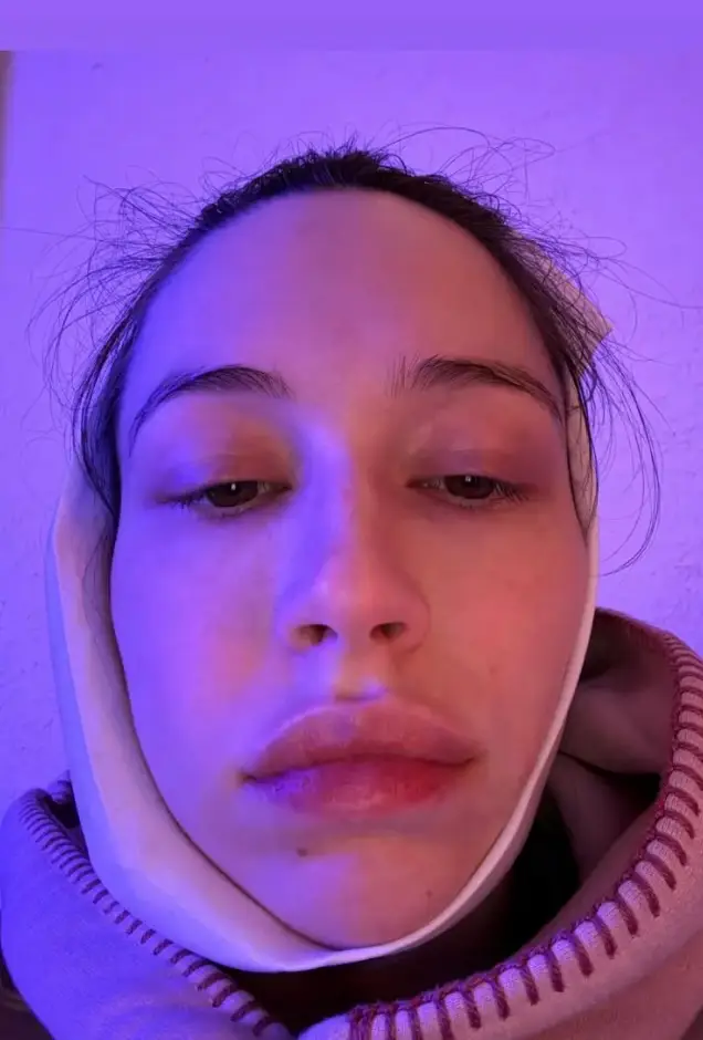 She also had an unexpected procedure while in the hospital giving birth (Instagram/@elsie)