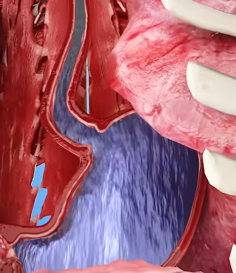 If you drink water very quickly then the excess can pass into your bloodstream (YouTube/Zack D Films)