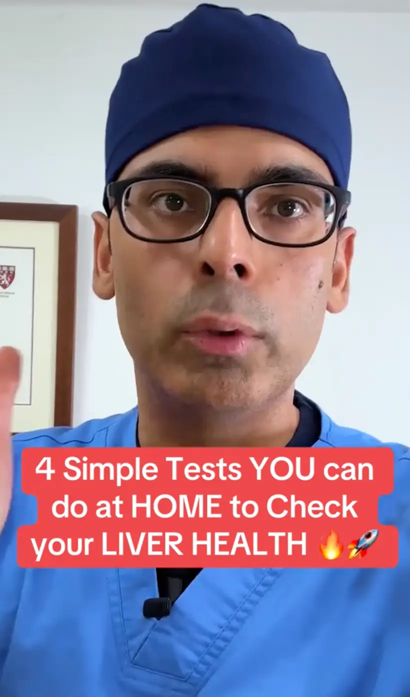 A doctor has shared how you can test your liver health at home (TikTok/@doctorsethimd)