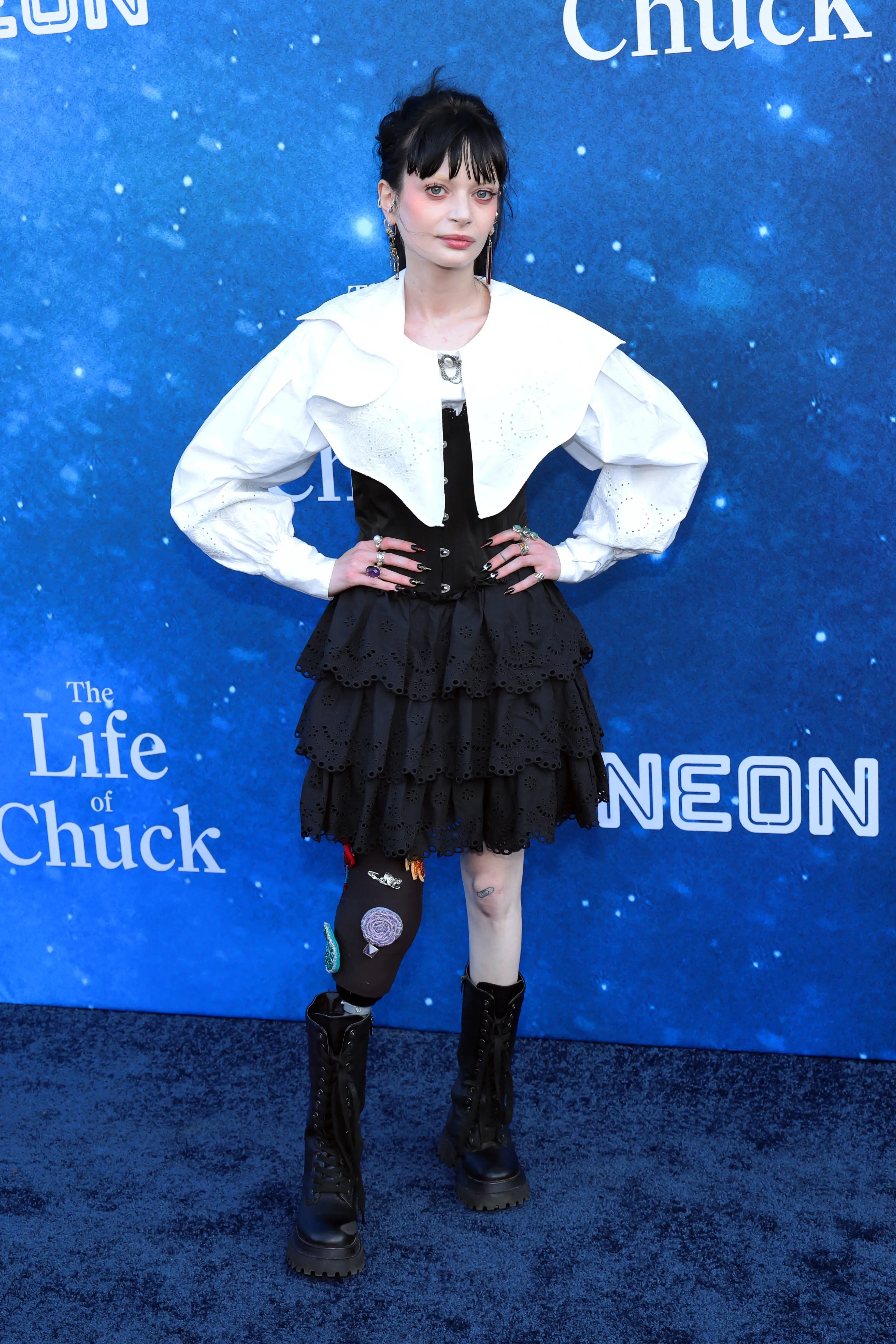 The Irish star explained that the major op would benefit her quality of life (Amy Sussman/Getty Images)