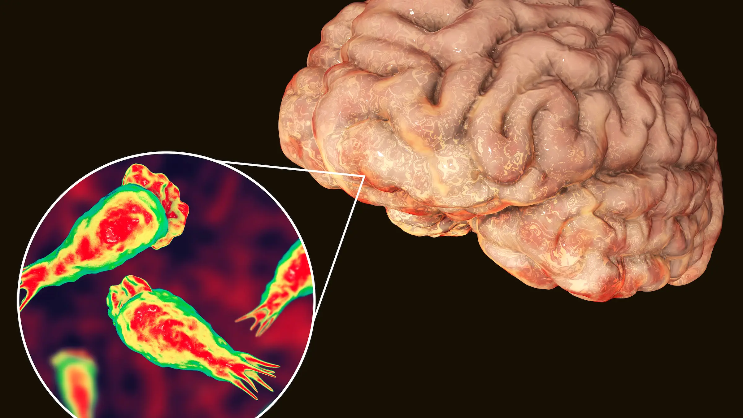 Getty Images/Science Photo Library