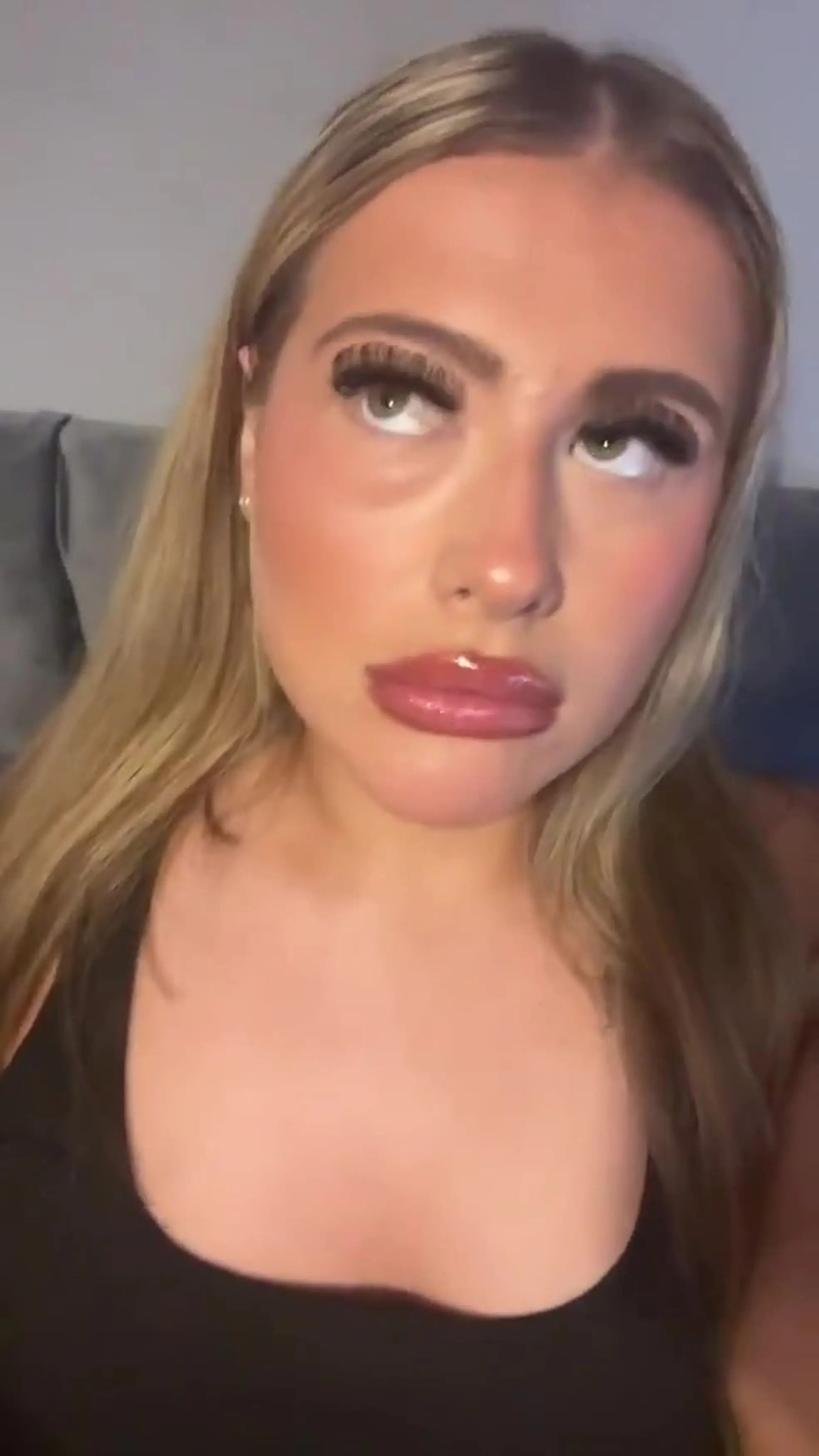 The Manchester teen would use false lashes to cover it up (Kennedy News and Media)