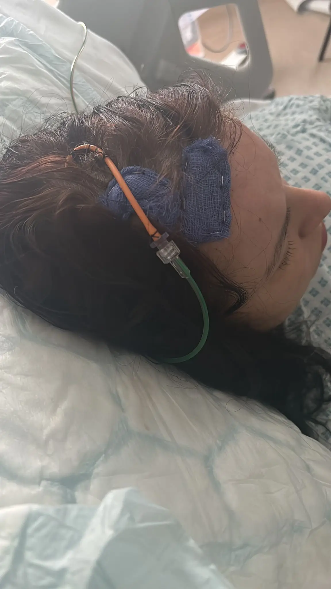 She had to undergo emergency brain surgery. (SWNS)