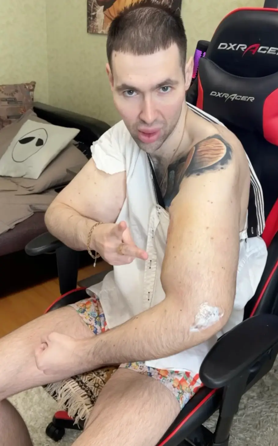 The Russian influencer revealed he has had 'surgery to remove the biceps' (Instagram/@ruki_bazuki_official)