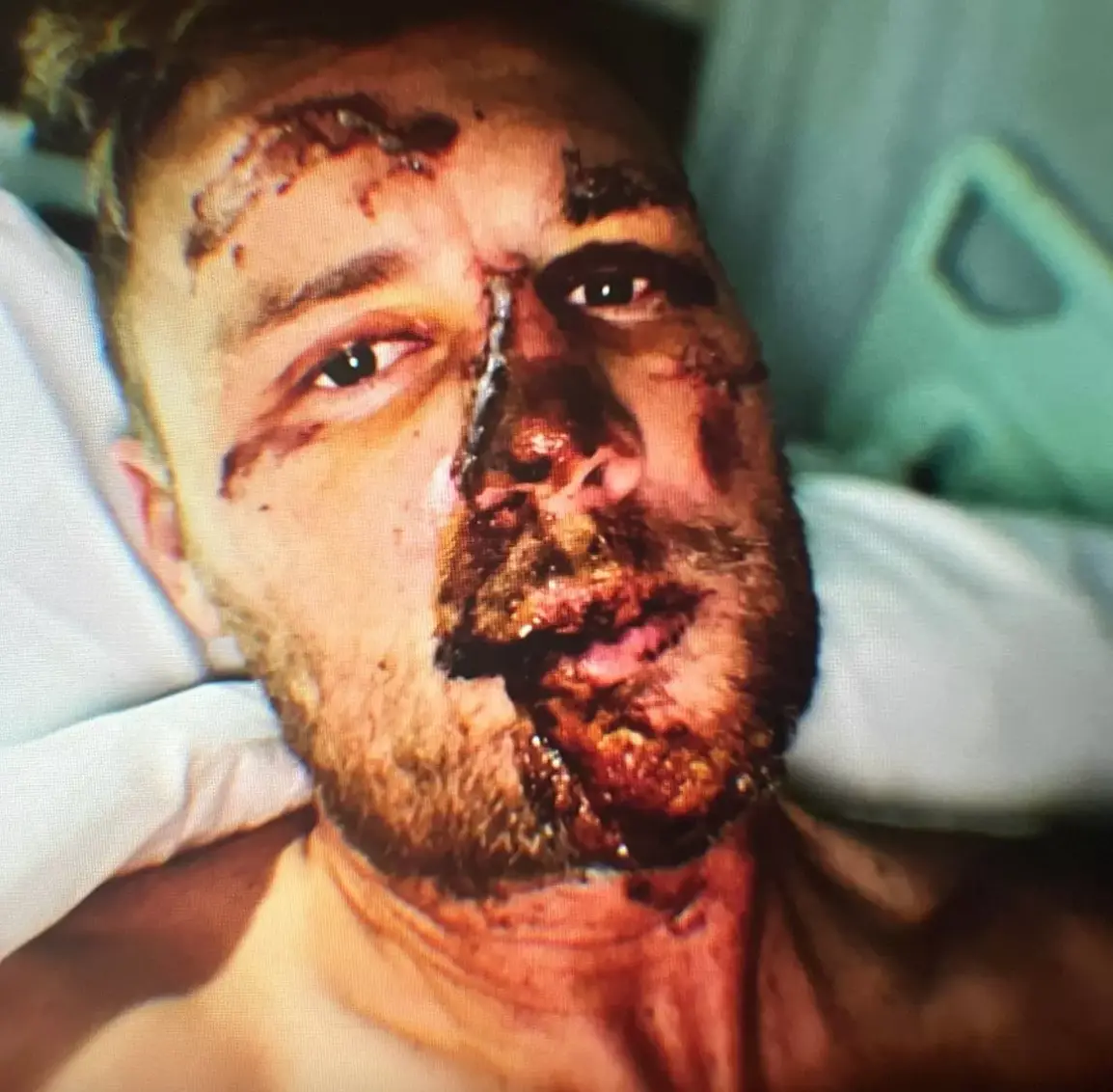 He admits he lived 'under the radar' in the months that followed. (Disney+)