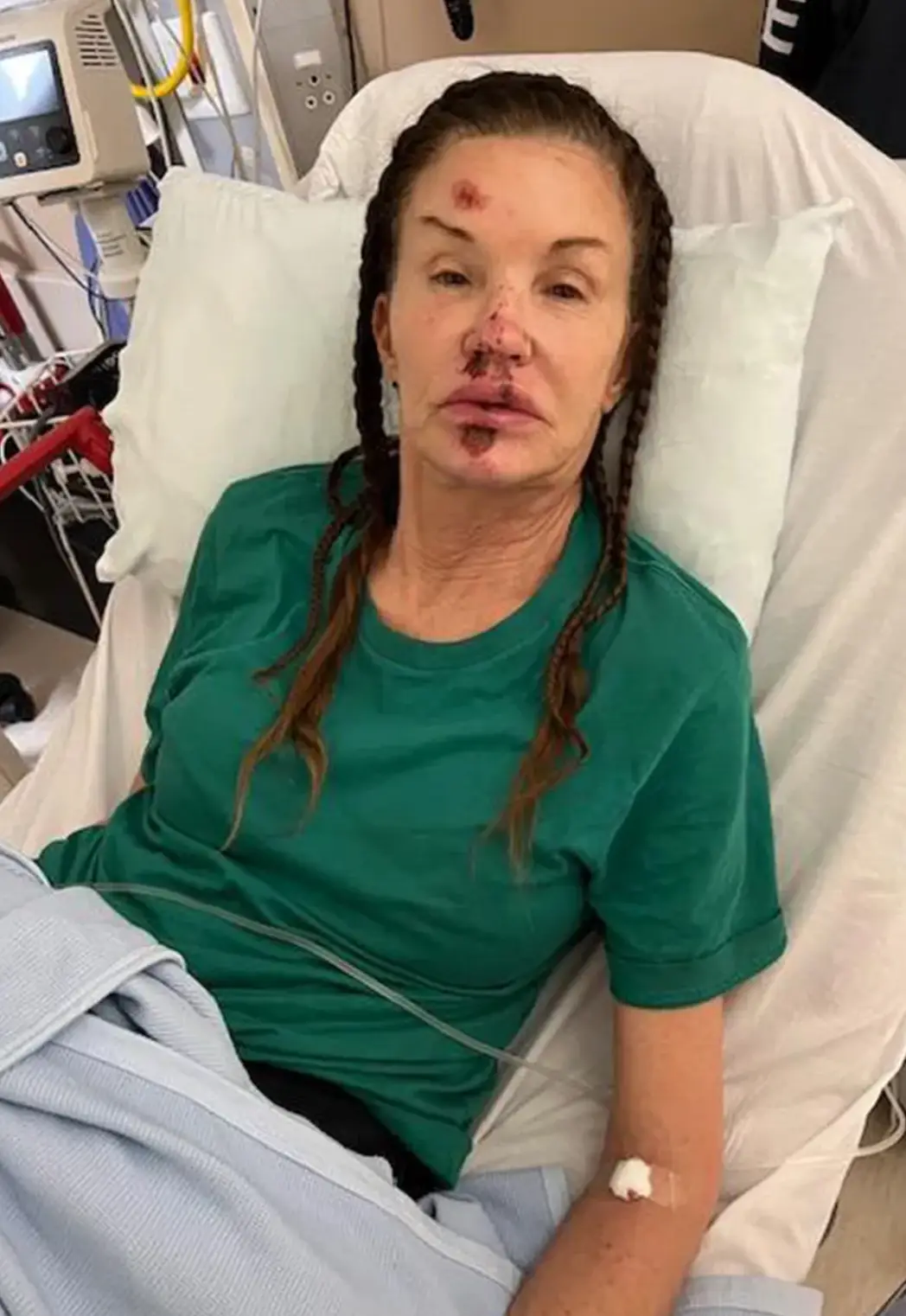 She suffered the serious fall during filming of the 2023 all-star series (Janice Dickinson)