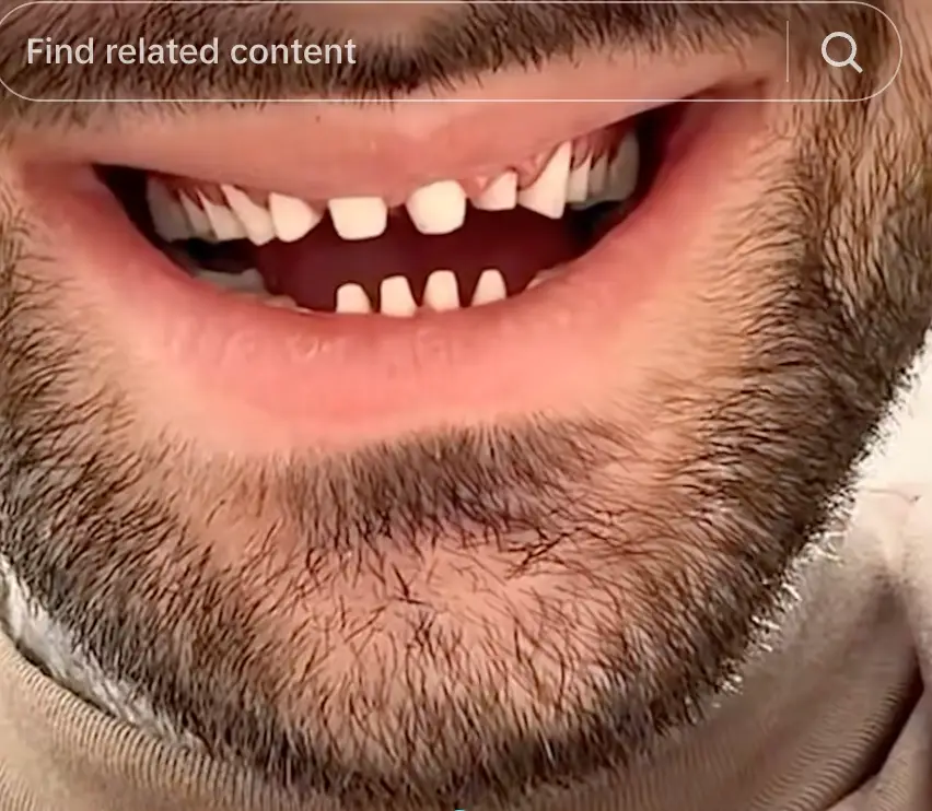 However dentists are urging people to not be lured in with low prices and pictures of dazzling smiles (YouTube/Harley Street Dental Studio)