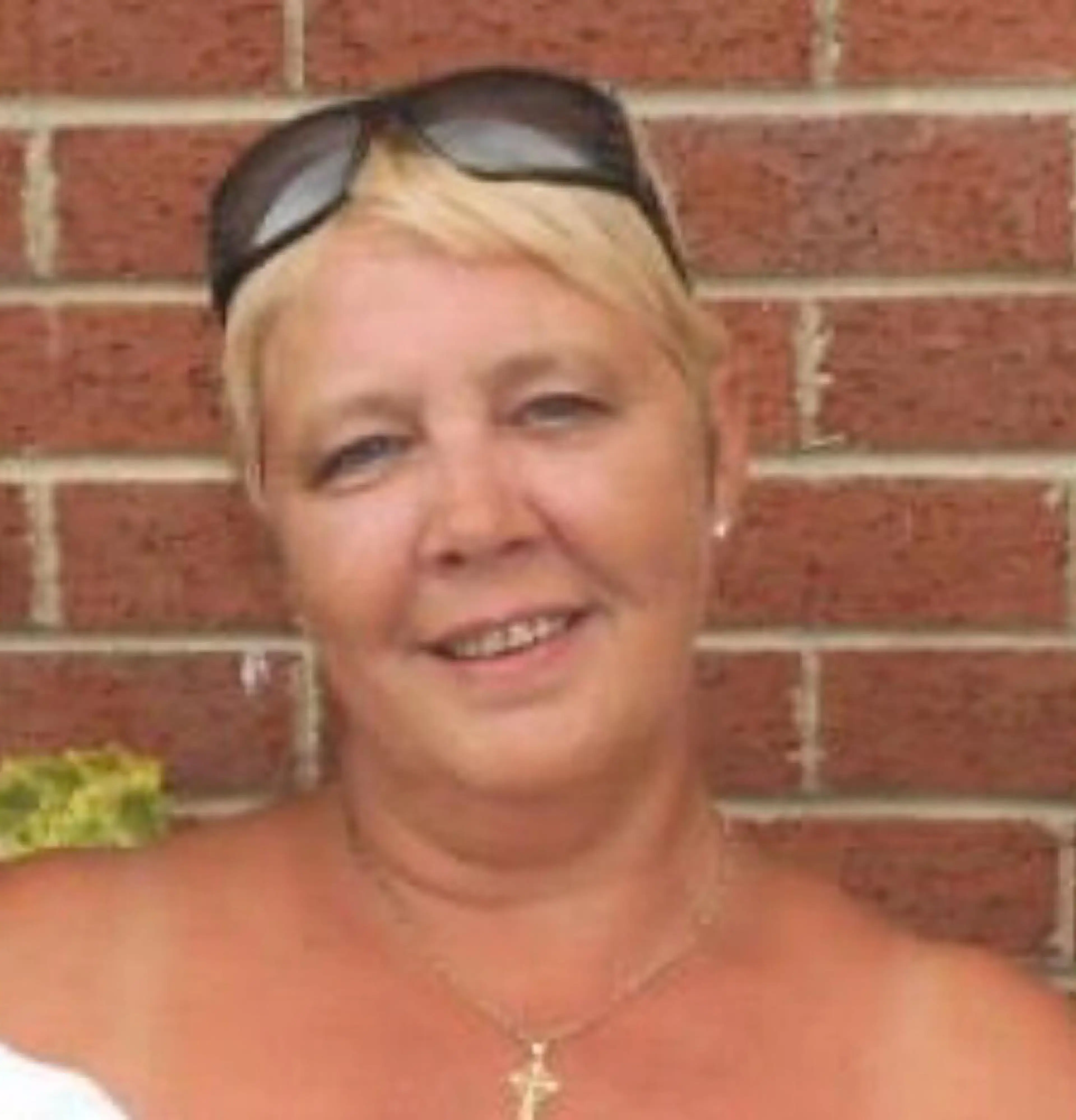 Jayne wanted to tighten the skin of her neck following a diet, pictured before her treatment.