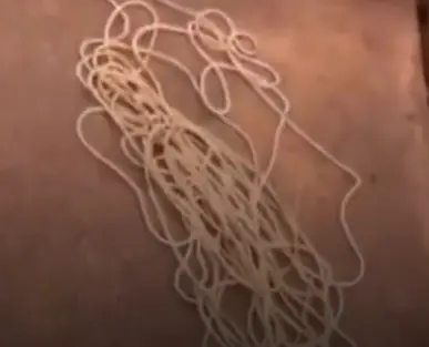 Allegedly, the rope wasn't attached (X)