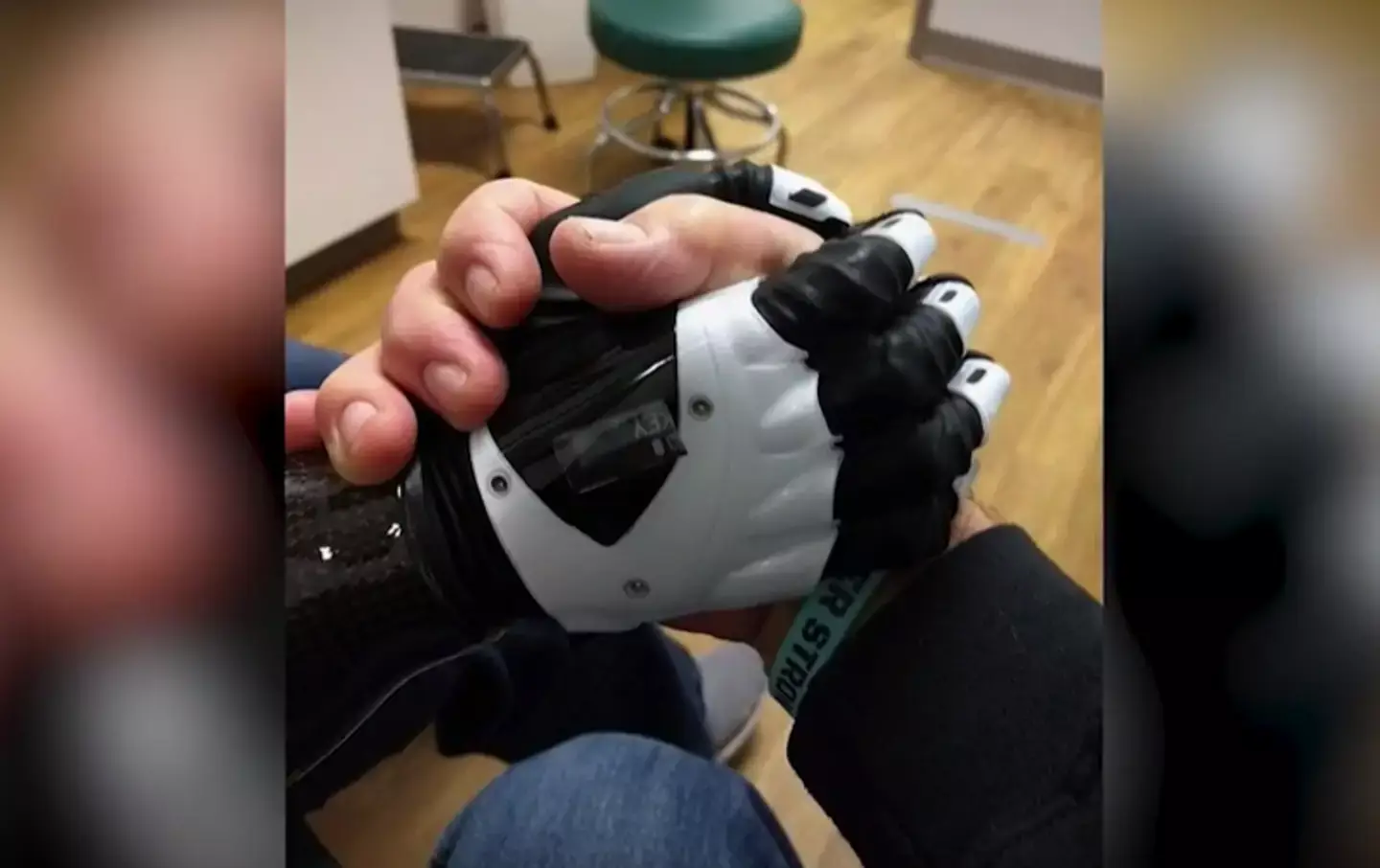 She has since made a recovery with the help of prosthetics (Marie Trainer)