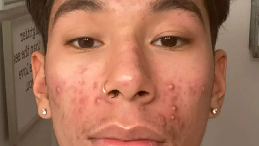 YouTube/Patrick Merino