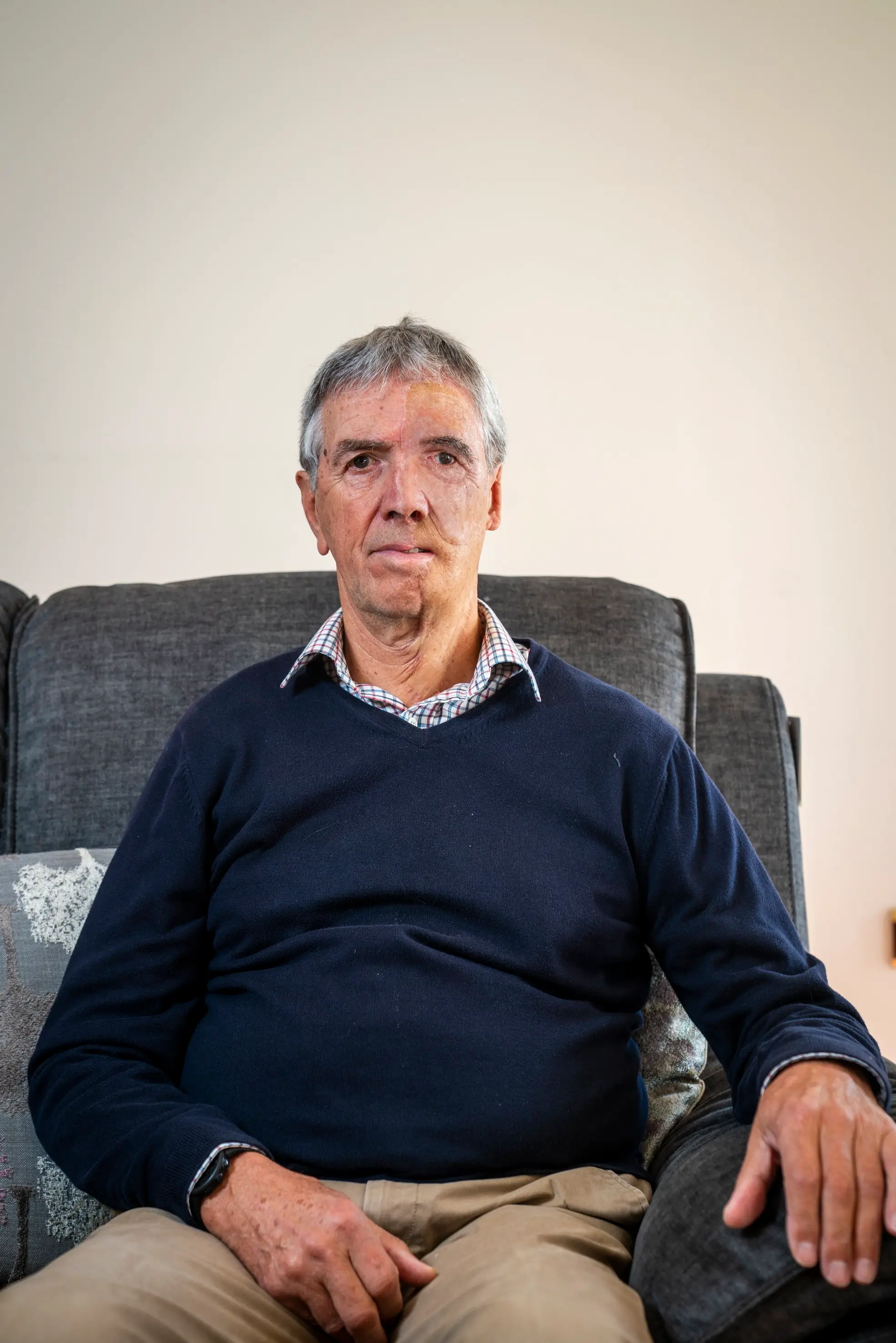 The team worked to match his natural face as closely as possible (SWNS)