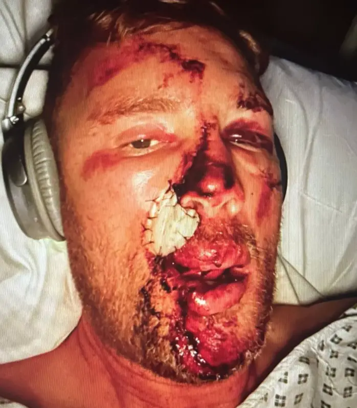 Flintoff thought his face 'had come off'. (Disney+)