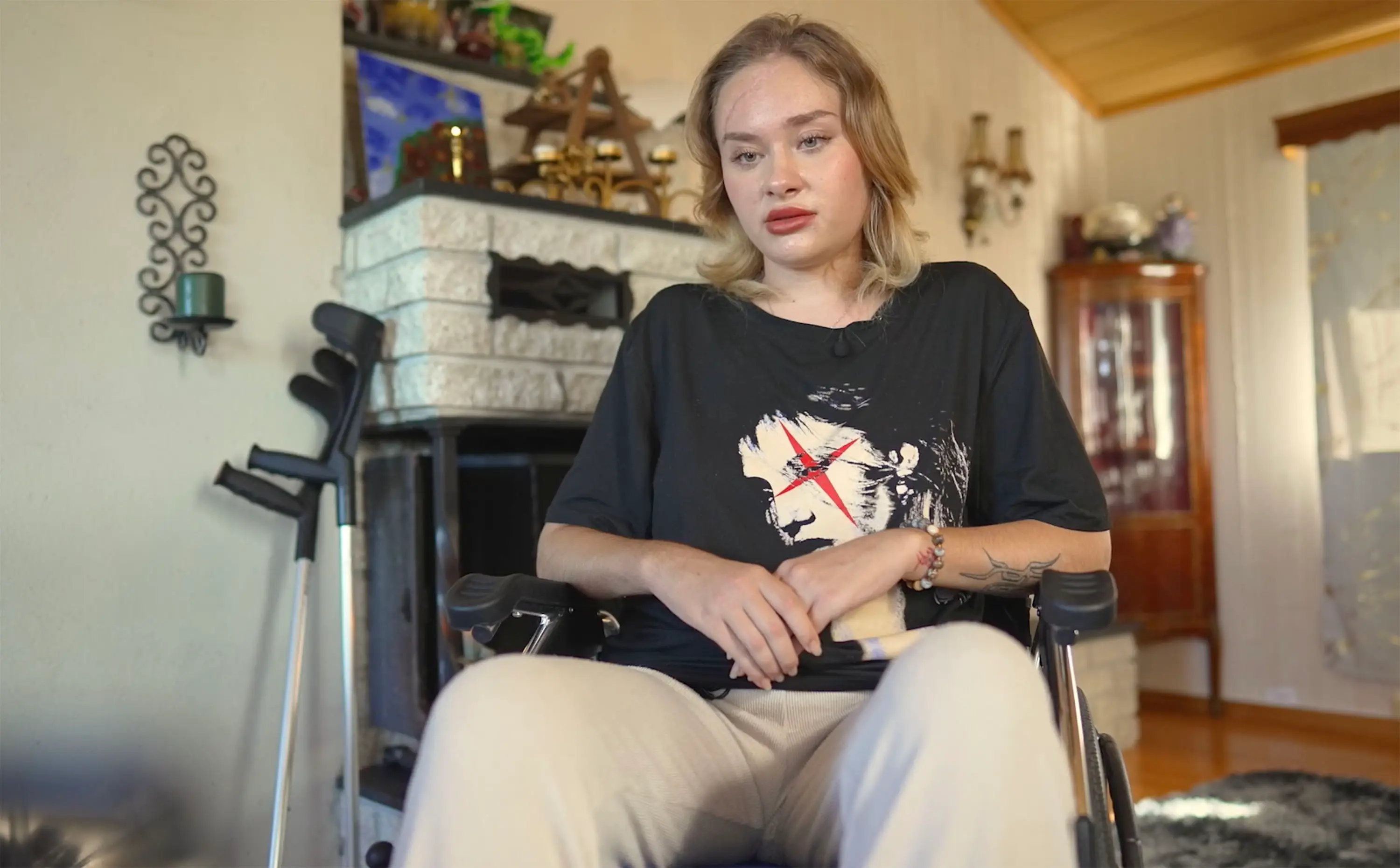 The OnlyFans model now relies on a wheelchair and crutches to walk (East2West)
