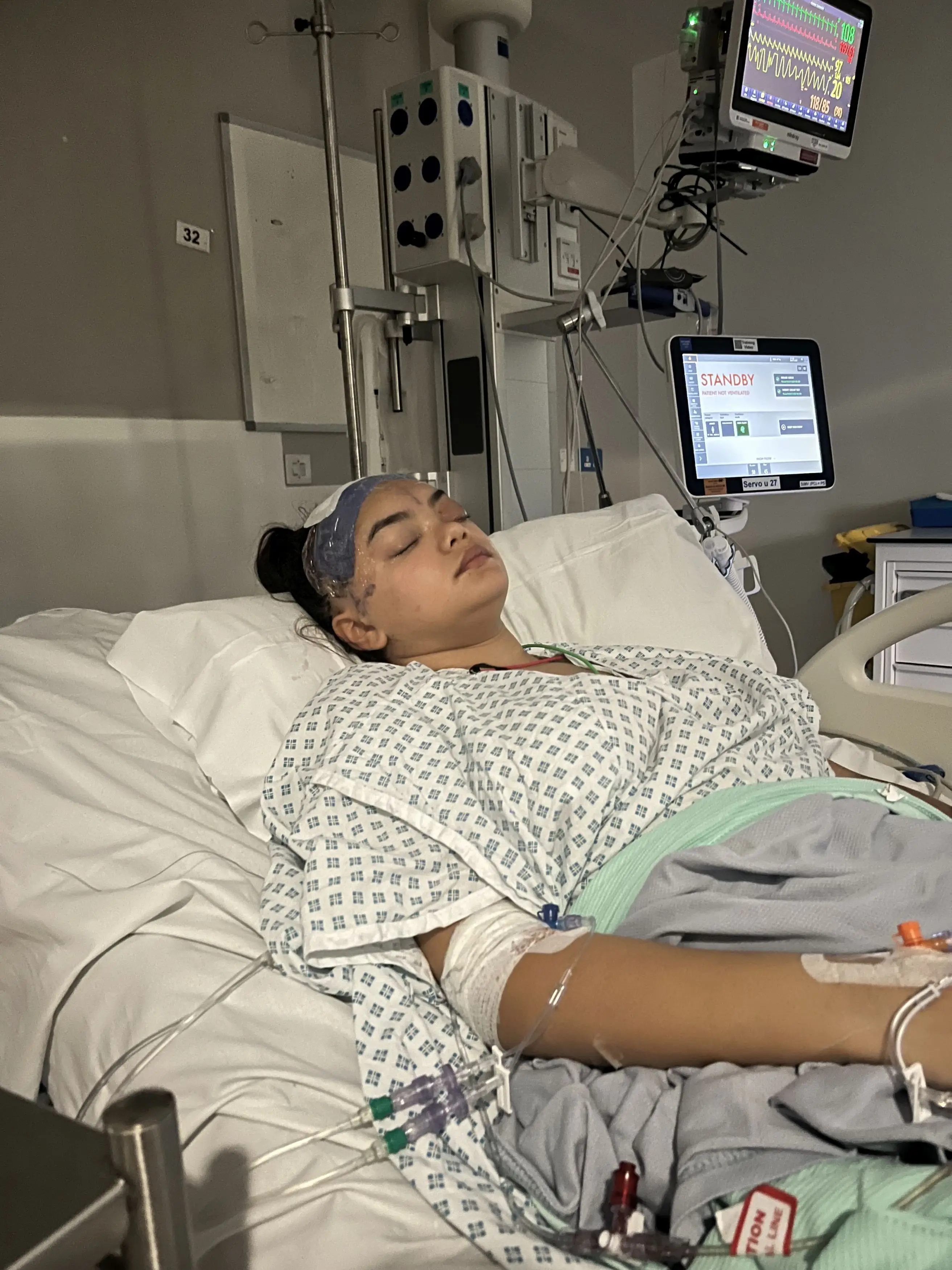 She had to undergo surgery to remove part of her skull to ease the infection (Kennedy News and Media)