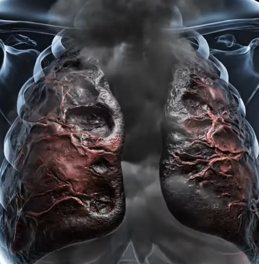 The sobering simulation shows how the health of your lungs deteriorates over time (YouTube/Health Cartoon Corner)