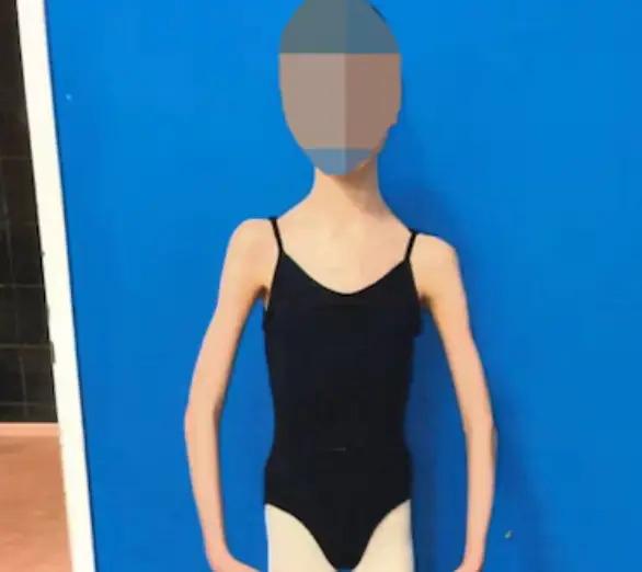 Her ballet teachers alerted authorities after becoming concerned that she was malnourished (District Court of Western Australia)