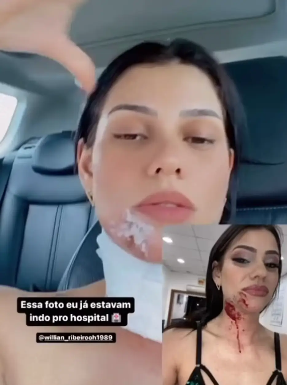 She has since issued an update on how she’s doing.