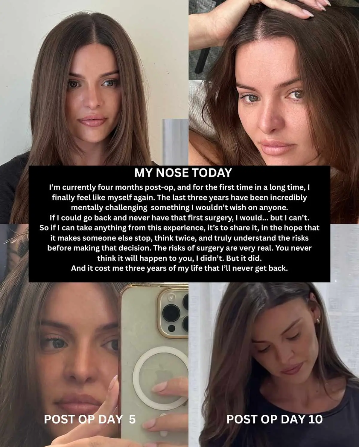Kim said she is four months post-op (Instagram/@kimhartnett_)