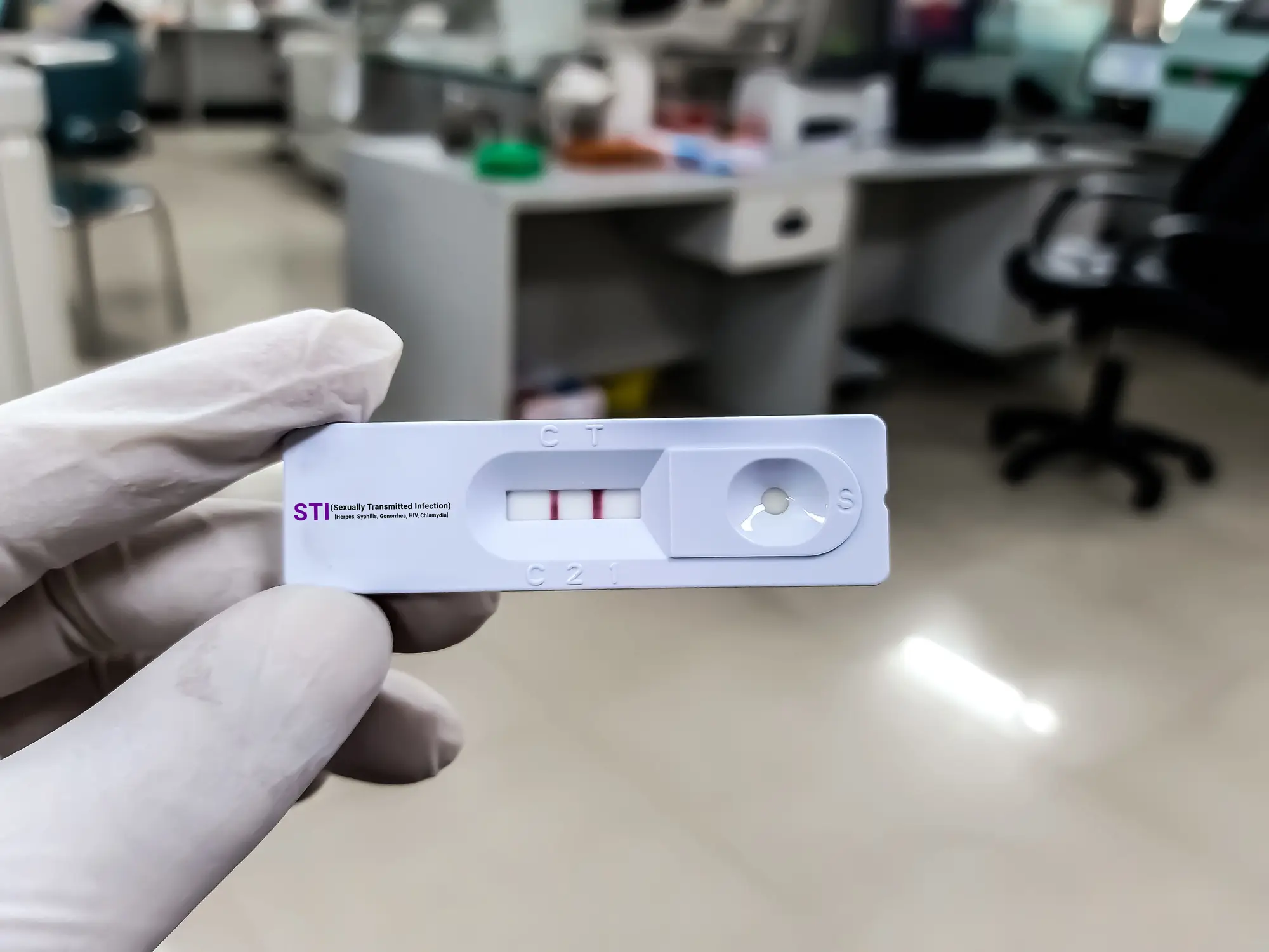 The doctor warned that if left undetected and untreated a 'silent STI' could have very serious consequences (Getty Stock Photo)