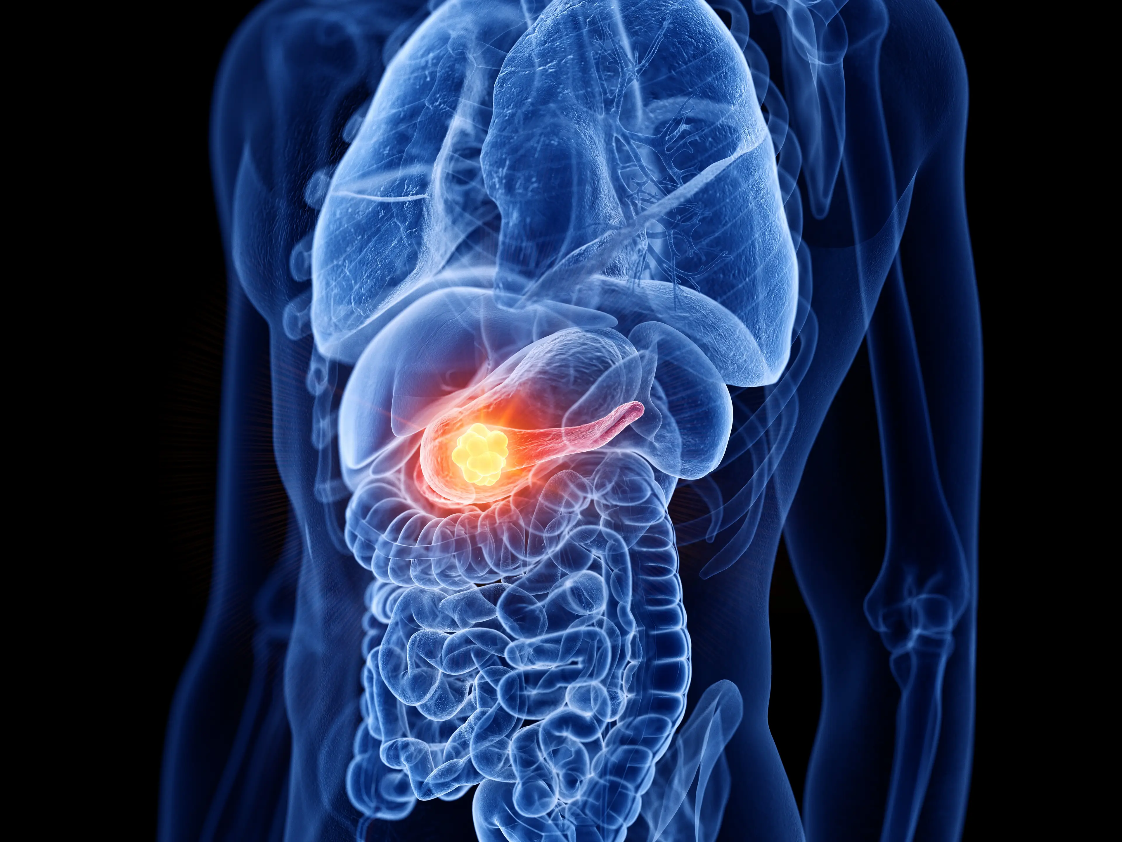 Pancreatic cancer is hard to detect due to the location of the organ and because it doesn't cause noticeable symptoms (Getty Stock Image)