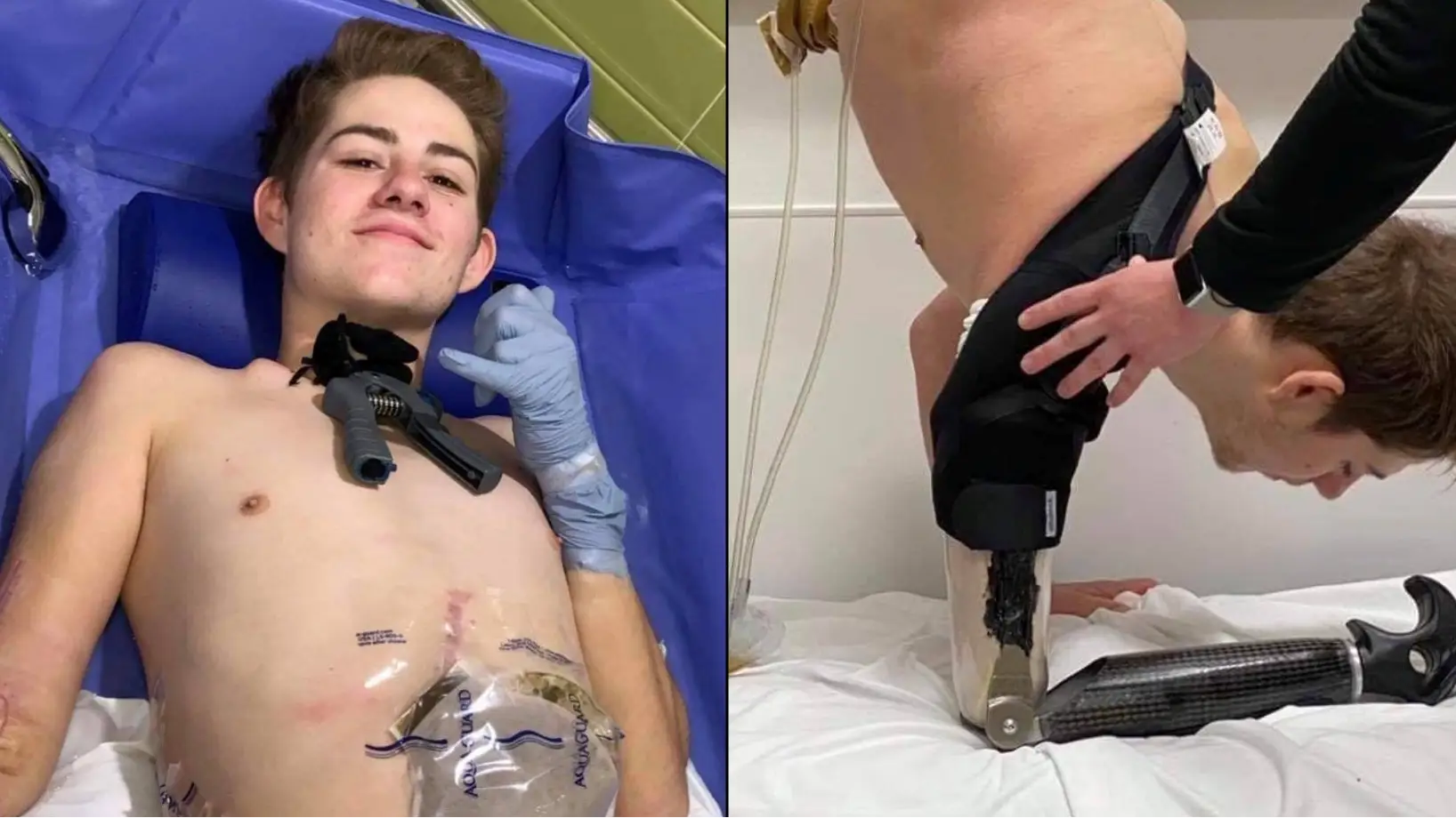 Man cut in half by forklift makes heartbreaking admission about his life since devastating accident